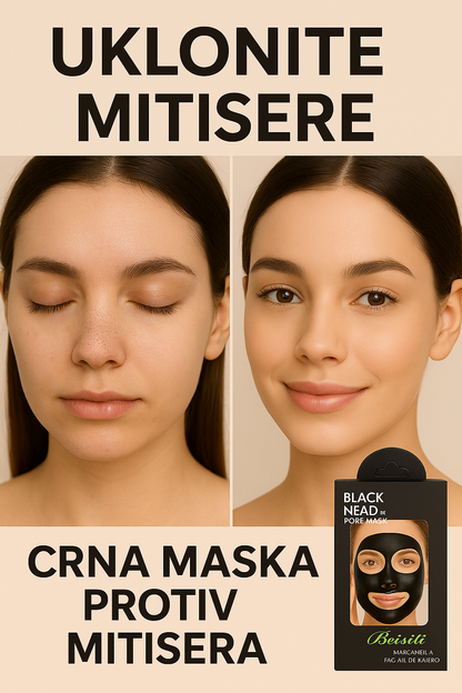 Crna Maska Protiv Mitisera (10kom) AKCIJA